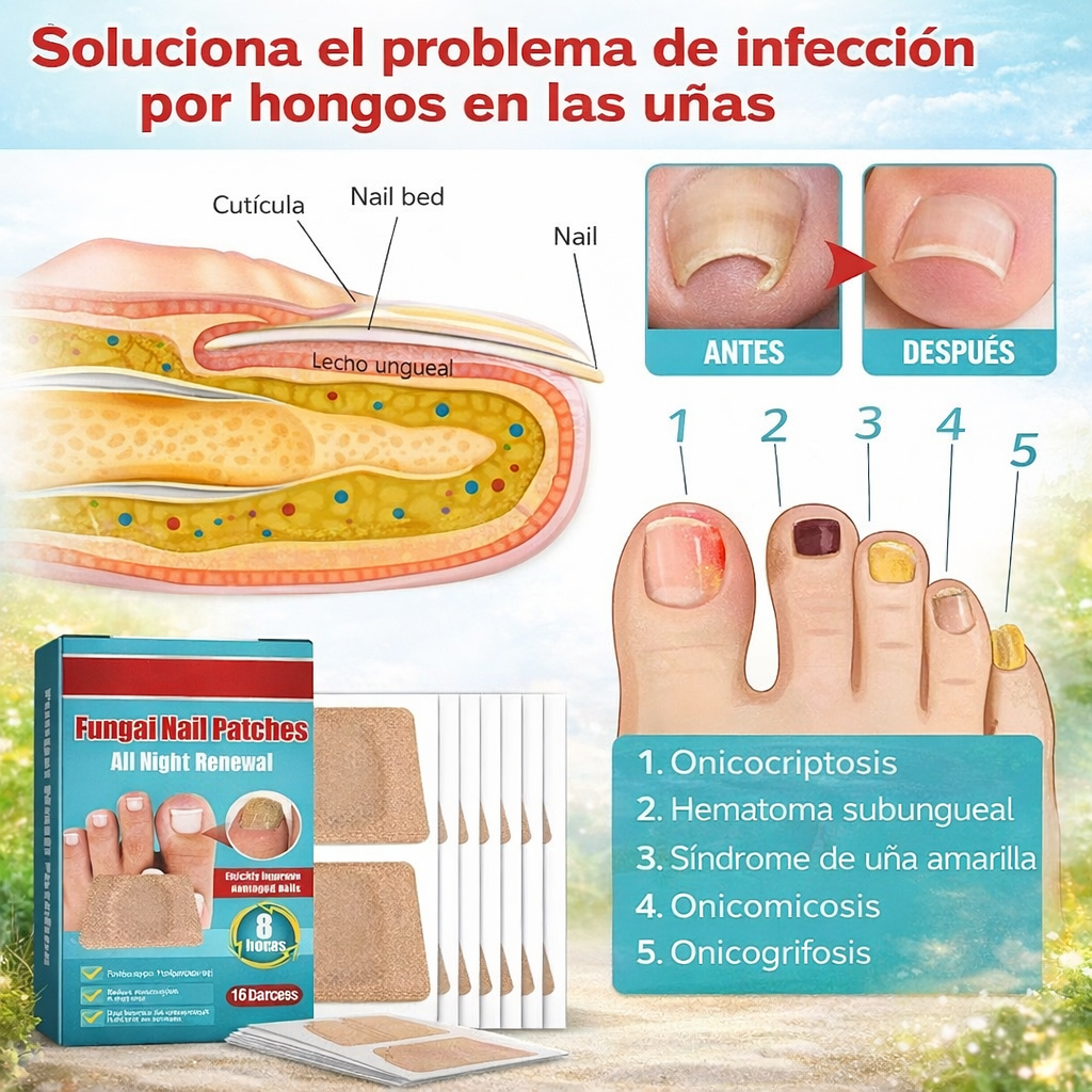 16 Parches Reparadores de Uñas – Tratamiento Antihongos Fácil y Seguro
